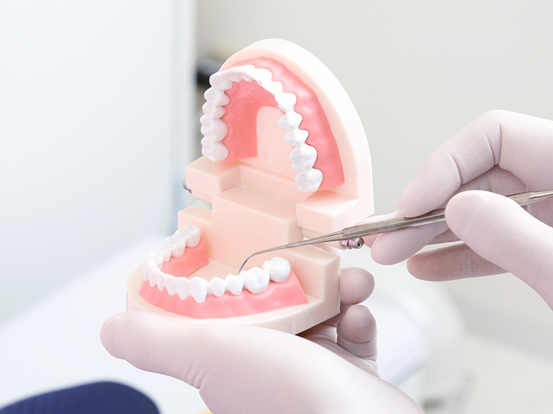 歯周病治療－再評価